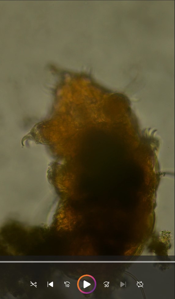 Tardigrade Echinischidae